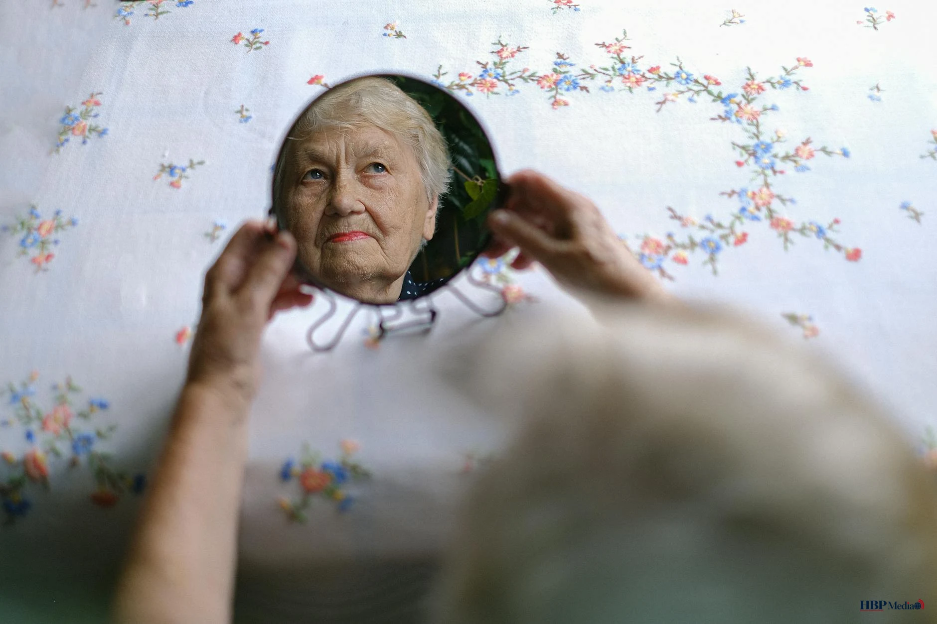 MRI-scan van hersenen bij Alzheimerpatiënt met zichtbare amyloïde-eiwitophopingen